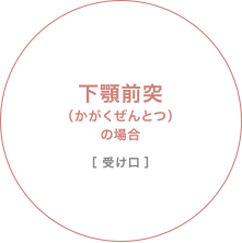 下顎前突（かがくぜんとつ）の場合